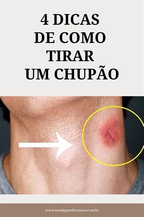 como tirar chupada|Como Tirar um Chupão: Dicas Eficazes e Rápidas